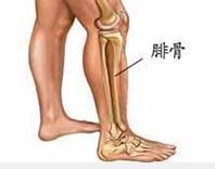 腓骨肌萎縮癥 遺傳性運動感覺神經病 Charcot-Marie-Tooth綜合征