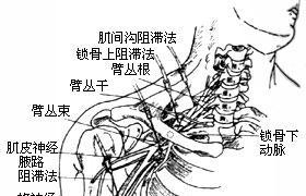 臂叢神經痛 痹證 筋痹 肩臂痛