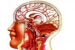 腦動脈硬化癥 腦動脈硬化 腦絡痹