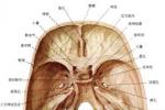 腦動脈硬化癥 腦動脈硬化 腦絡痹