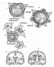 肌萎縮側索硬化