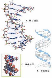 包涵體肌炎 散發性包涵體肌炎