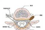 腦血管疾病 腦中風 腦血管意外 腦卒中