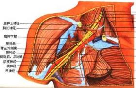 麻痹性臂叢神經炎 神經痛性肌萎縮