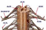 脊髓壓迫癥 脊髓壓迫 compressivemyelopathy