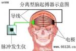 肌張力障礙綜合征 肌緊張不足綜合征 肌張力障礙 肌張力障礙綜合癥