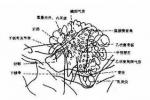 急性化膿性腦膜炎 腦脊膜炎 腦膜炎 髓膜炎