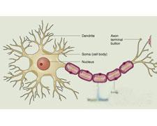 多發性末梢神經炎 Multiple peripheral neuritis 末梢神經炎