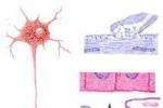 多發性末梢神經炎 Multiple peripheral neuritis 末梢神經炎