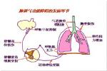 肺性腦病 肺心腦綜合征 肺厥