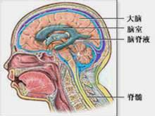 腦脊液漏