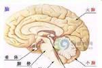 手足徐動性腦癱 手足徐動性腦性癱瘓