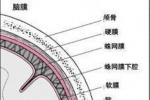 硬脊膜下膿腫