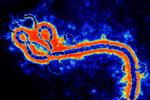 埃博拉病毒 A98.451 埃博拉病毒性疾病 埃博拉出血熱