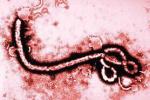 埃博拉病毒 A98.451 埃博拉病毒性疾病 埃博拉出血熱