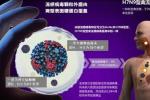 H7N9禽流感 H7N9型禽流性感冒