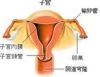 結核性盆腔炎 生殖器結核