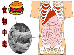 食物中毒