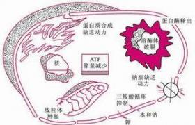 感染性休克 R57.801 膿毒性休克