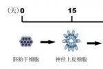 亨廷頓病性癡呆 G10.X51+ 杭廷頓病性癡呆 亨廷頓氏病性癡呆