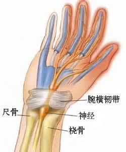 鼠標手 腕管綜合征 遲發性正中神經麻痹