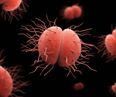 單純淋球菌和急性淋病有什麼區別