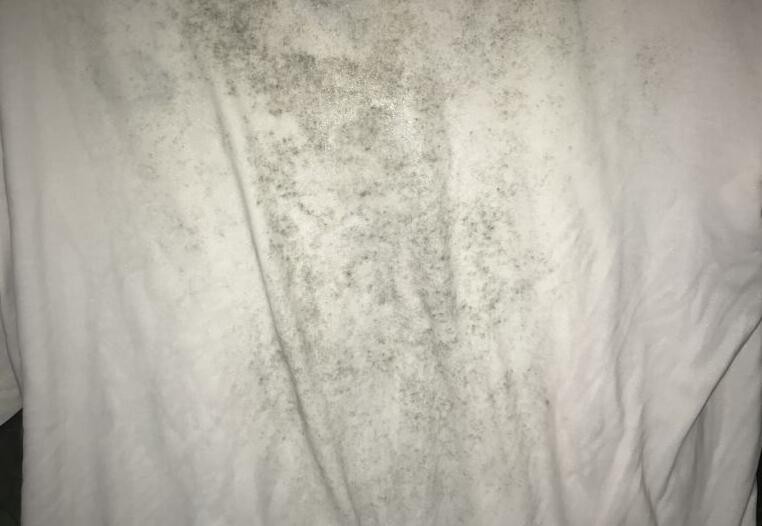衣服上有黴點怎麼洗掉