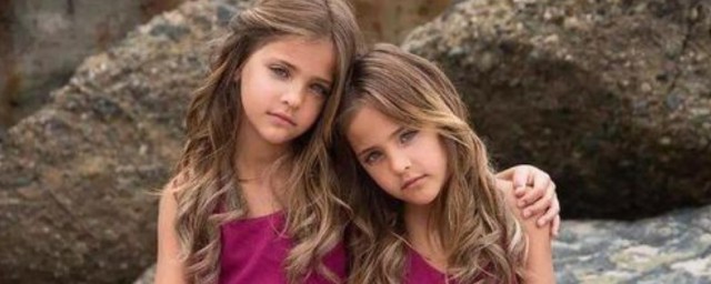 雙胞胎女孩名 雙胞胎女孩名有哪些