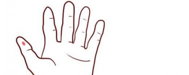 手指有痣代表什麼意思 手指有痣有什麼含義
