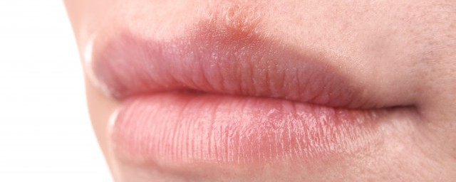 淡化唇紋的方法 如何淡化唇紋