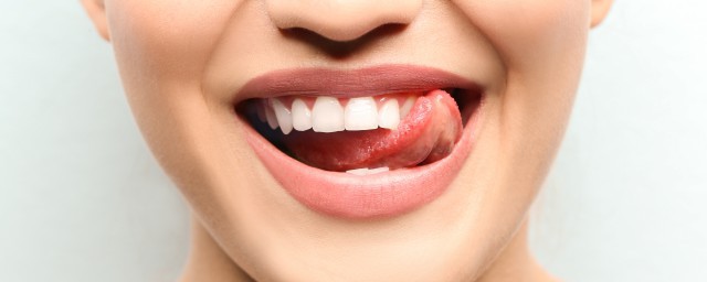 美白牙齒的方法有哪些 怎麼美白牙齒