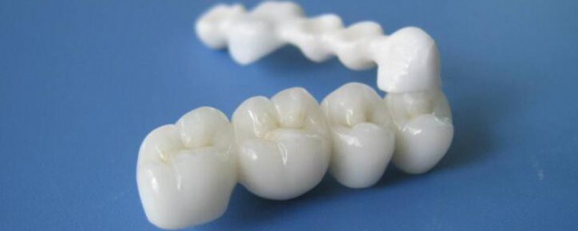 牙齒修復的幾種方法 牙齒修復的方法有哪些