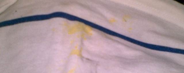 洗衣服黃斑方法 洗衣服黃斑方法分享