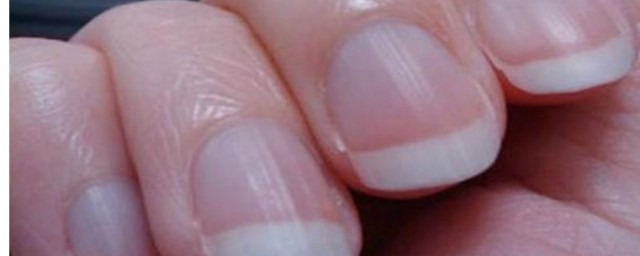 手指上的月牙白代表什麼 手指上的月牙白說明瞭什麼