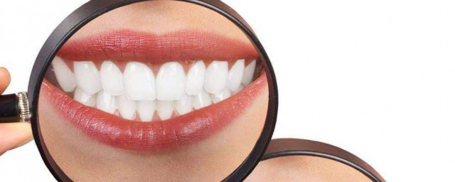 如何讓牙齒快速變白 讓牙齒快速變白的方法