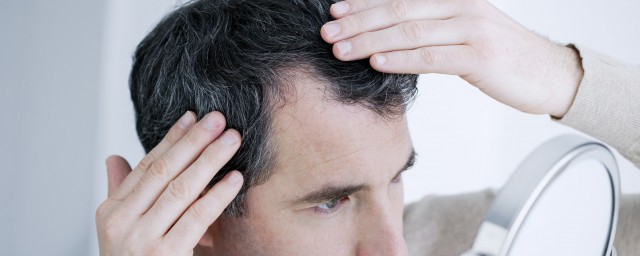 頭皮癢頭皮屑多有可能傳染嗎 頭皮屑多該怎麼辦