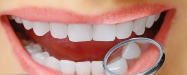 什麼可以美白牙齒 牙齒美白方法