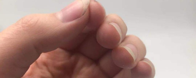 手指甲沒有月牙正常嗎 平時要註意什麼