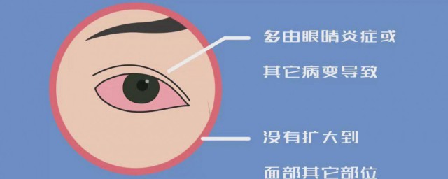右眼跳代表什麼 右眼跳是什麼預兆