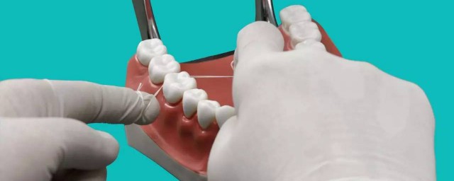 如何使用牙線 使用牙線的方法