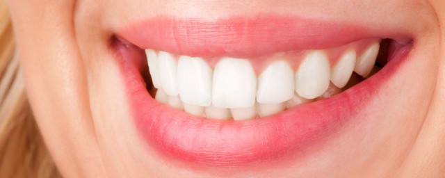 牙齒變白的方法 牙齒變白的技巧