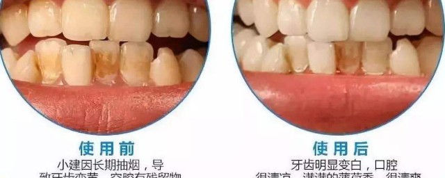 怎麼讓牙齒變白 你知道嗎