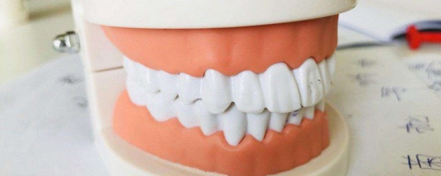 怎樣美白牙齒 美白牙齒方法