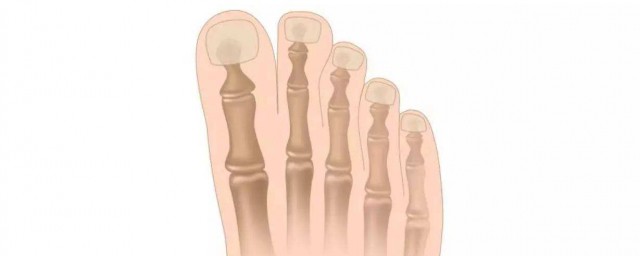 趾骨是哪個位置 趾骨的簡介