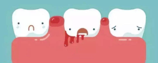 一刷牙就出血怎麼辦 一刷牙就出血的解決方法