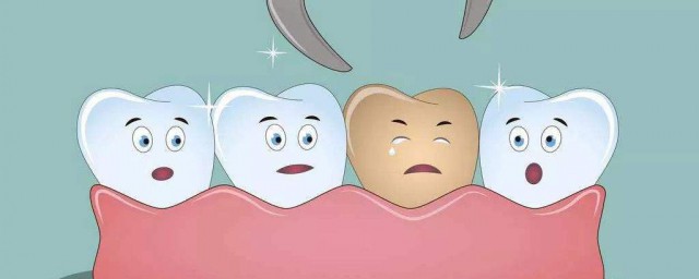 蛀牙疼怎麼辦教你立刻止疼 蛀牙疼止疼的方法