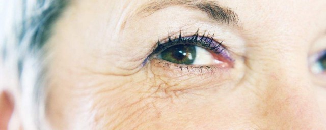 如何避免眼皺紋 避免眼皺紋的方法