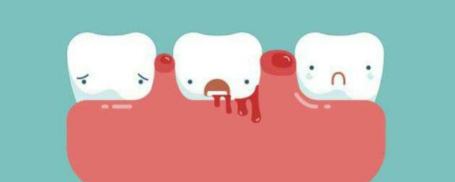 刷牙出血是怎麼回事 刷牙出血的原因是什麼