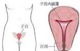 子宮內膜薄 子宮內膜變薄