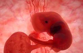 胚胎停育 胎停孕 胎停育 死胎